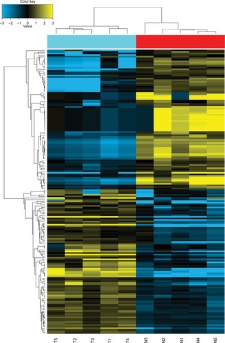 Figure 1 Heatmap of the 181 dysregulated miRNAs.Notes: Hierarchical analysis of the 181 dysregulated miRNAs based on the comparison of their expression values in PTC and normal tissues. Data have been deposited in GEO (accession code GSE113629).Abbreviations: GEO, Gene Expression Omnibus; miRNAs, microRNAs; PTC, papillary thyroid carcinoma; T, tumor tissues; N, normal tissues.