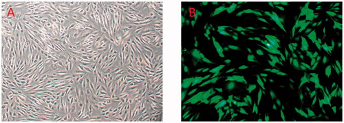 Figure 1. (A) Synovial cells (×100). (B) Synovial cells transfected with lentivirus pGPHI/GFP/Neo-shRNA vector (×100).