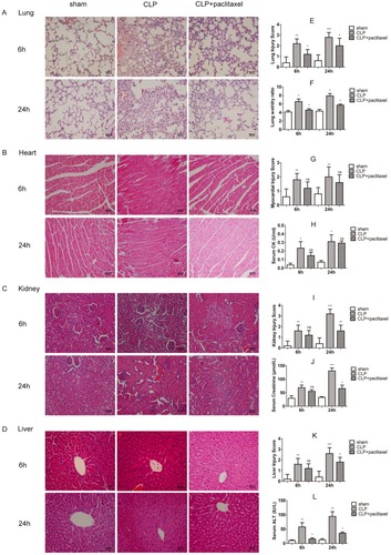 Figure 2 Protection of paclitaxel on organ injuries in septic mice. (A–D) Representative morphological images at 6 and 24 hrs by HE staining were presented to assess the injury severity of lungs, heart, kidney and liver. (E, G, I, K) Histological scores of organ injury were calculated. Lung wet/dry ratio (F), sera creatine kinase (H), sera creatinine (J) and sera alanine aminotransferase (L) were also tested. Samples were harvested at 6 and 24 hrs after CLP. Data represent means ± SD (n=6). *P<0.05, **P<0.01, ***P<0.001.