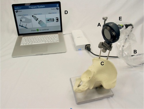 Figure 2 The Intellijoint HIP system.