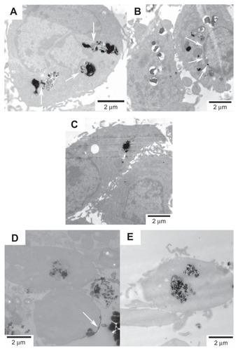 Figure 9 Representative TEM images showing the uptake of FePt NPs with different components and surface coatings by human astrocytoma U87 cells at the exposed dose of 25 μg/mL after 24 hours’ incubation.Notes: (A) Fe60Pt40-OA/OA; (B) Fe45Pt55-OA/OA; (C) Fe27Pt73-OA/OA; (D) Fe60Pt40- Cys; (E) Fe24Pt76-Cys. The release and diffusion of FePt NPs from the vesicles into the cytoplasm were observed and are marked with white arrows in panel (A); the penetration of FePt NPs through the nuclear membrane was shown and is marked with white arrows in panel (B). The adsorption of FePt NPs on the surface of cellular membrane was shown and is marked with a white arrow in panel (D).Abbreviations: TEM, transmission electron microscopy; NPs, nanoparticles; OA/OA, oleic acid/oleylamine; Cys, cysteine.