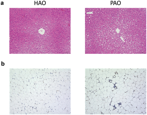 Figure 1.  Oral gavage of periodontitis-associated oral microbiota and health-associated oral microbiota have distinct effects on liver and adipose tissue histology. (A) Hematoxylin and eosin staining of the liver (scale bars, 100 μm) of periodontitis-associated oral microbiota-administered (PAO) and health-associated oral microbiota-administered (HAO) mice. (B) Epididymal adipose tissues of PAO and HAO mice stained with a rat anti-mouse F4/80 primary antibody. Representative images (HAO #1 and PAO #1, respectively) of three HAO and four PAO mice.