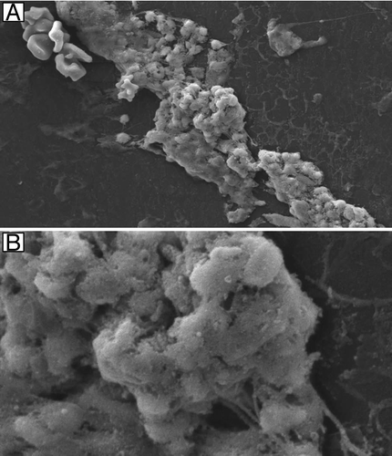 Figure 2 Mature in vivo C. albicans biofilm formation during rabbit model development. Scanning electron micrographs of C. albicans biofilms adherent to the intraluminal surface of catheters showing biofilm architecture at 7 d post-infection (A) magnification, 1,500x (B) magnification, 6,500x. There was no difference in biofilms at 3 d post-infection (data not shown). Adapted from Schinabeck et al.Citation8