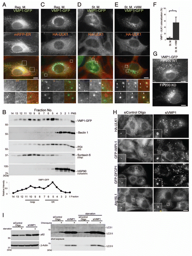 Figure 7 VMP1 localizes to the early autophagic structure. (A and C–E) MEFs stably expressing VMP1-GFP and RFP-ER or HA-ULK1 were cultured in regular or starvation medium, with or without 0.2 µM wortmannin for 1 hour. Cells were subjected to immunofluorescence microscopy using anti-HA antibodies. Colocalization between VMP1 and ULK1 is indicated by arrowheads. (B) MEFs stably expressing VMP1-GFP were cultured in regular medium and subjected to subcellular fractionation as described in Materials and Methods. Immunoblot analysis showed the distribution of VMP1-GFP, Beclin 1, protein disulfide isomerase (PDI, ER marker), syntaxin 6 (Golgi marker) and HSP90 (cytoplasmic protein marker). (F) Graph shows the result of quantification of colocalization between VMP1 and ULK1. The Y axis indicates VMP1-positivity (%) of the ULK1 puncta. Results shown represent mean ± SE of 10 cells. *p < 0.01, Student's t-test. (G) Wild-type and FIP200 KO MEFs stably expressing VMP1-GFP were observed under nutrient-rich conditions. (H) HeLa cells stably expressing HA-ULK1, GFP-WIPI-1 and GFP-DFCP1 were treated with VMP1 or control siRNA oligos. Cells were cultured in starvation medium for 1 hour, and then subjected to immunofluorescence microscopy using anti-HA, anti-GFP and anti-Atg16L1 antibodies. signal color (A and C–E) is indicated by color of typeface. Reg. M., regular medium; St. M., starvation medium; WM, wortmannin. Scale bars, 10 µm (white) and 1 µm (yellow). (I) HeLa cells were treated with VMP1 or control siRNA oligos, as indicated. Cells were cultured in starvation medium for 2 hours with or without 20 mM choloroquine and then starvation-induced p62 degradation and lysosomes-dependent LC3 turnover was determined by immunblot analysis.