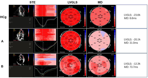 Figure 2 Representative Images of Two-dimensional Speckle Tracking Technique in Left Ventricle of Patients in HCg and RHD Groups.