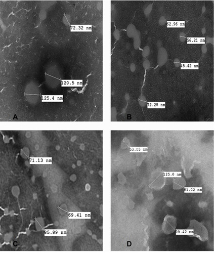 Figure 2 Transmission electron microscopy images of (A) conventional liposomes; (B) transfersomes; (C) flavosomes-Q; (D) flavosomes-D.