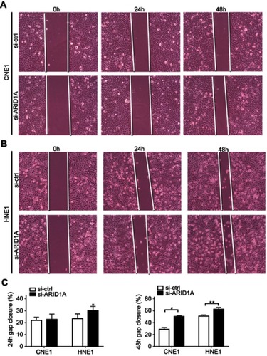 Figure S2 ARID1A knockdown promoted cell migration in NPC cells by wound scratch assays. *P<0.01, **P<0.05, #P<0.001.