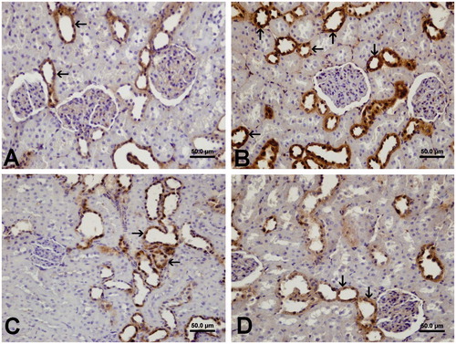 Figure 3. Immunohistochemical localization of HSP-70 expression of the kidney tissue in the different groups. (A) Expression of HSP-70 was prominent in the distal tubules and collecting ducts in group 1. (B) Increased expression of HSP-70 was shown in the distal tubules and collecting ducts in group 2. (C) HSP-70 immunostaining was observed in the distal tubules and collecting ducts in group 3. (D) HSP-70 expression was shown in the distal tubules and collecting ducts in group 4.