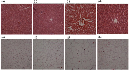 Fig. 3 Histological sections of liver and white adipose tissue. (a) normal liver histology of Control rats; (b) normal liver histology of Control+LA rats; (c) steatosis, inflammation and, fibrosis in Model rats; (d) attenuated lipid deposition and inflammation in Model+LA rats; (e) normal WAT histology of Control rats; (f) normal WAT histology of Control+LA rats; (g) hypertrophic adipocytes in Model rats; (h) smaller adipocytes in Model+LA rats.