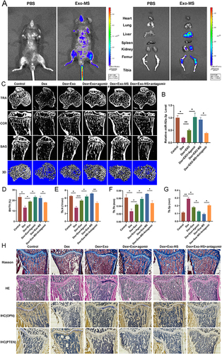 Figure 8 In the GIOP mouse model, the regulation of osteogenesis is mediated by exosomal miR-92a-3p. (A) Biophoton images of vivo and organ distribution 24 hours after injection of PBS and DIR labeled exosomes into the tail vein of mice. (B) Real-time PCR was used to verify the expression level of miR-92a-p in bone tissue. (n=3) (C) To assess trabecular levels of tibial plateau bone in different treatment groups, microCT scans were performed. (D–G) Quantitative analyses were conducted on Bone volume fraction (BV/TV, BV: bone volume, TV: total volume), trabecular number (Tb.N), trabecular thickness (Tb.Th) and trabecular spacing (Tb.Sp). (n=3) (H) HE staining was used to observe the distribution and morphology of bone trabeculae and other structures in bone tissue. Masson staining was used to observe the number of collagen fibers and tissue remodeling (blue: collagen fibers, red: cellulose, red blood cells). Immunohistochemical staining was performed to detect the expression levels of OPN and PTEN in the tibial plateau of mice from different treatment groups. The data are expressed as the mean ± SD (n = 3); *p < 0.05; **p < 0.01; ***p < 0.001.