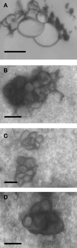 FIG. 3 Transmission electron micrographs of lipoplexes at a liposome:DNA ratio of 6:1 (w/w) A (MS10) and C (MS11) and 7:1 (w/w) B (MS10) and D (MS11). Bar = 100 nm.