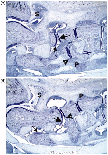 Figure 3. Effects of NEM on morphologic pathology ankle joint. Panel A: Ankle from an arthritis vehicle control animal (with the approximate mean summed score for the group; animal # 7, left ankle) has severe inflammation (S) and moderate cartilage damage (large arrow) with mild pannus (small arrow) and bone resorption (arrowhead), as well as moderate periosteal bone formation (P). Panel B: Ankle from an arthritic animal treated with NEM-8011510 (with the approximate mean summed score for the group; animal #7, left ankle) has marked inflammation (S) and mild cartilage damage (large arrow) with minimal pannus (small arrow) and bone resorption (arrowhead), as well as mild periosteal bone formation (P). Each slide was evaluated at 16× magnification.