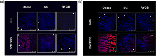 Figure 8 The fluorescence microscopic image 2 hours after oral administration of Nile red labeled suspension (SUS) and SNEDDS in (a) stomach and (b) small intestine of obese, SG and RYGB. Triangles indicate the lumens.