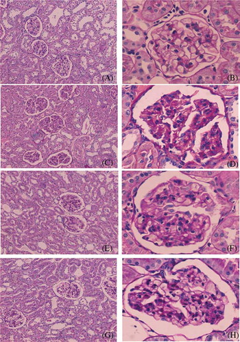 Figure 3. Representative light micrographs of kidney sections, stained with periodic acid-Schiff technique: (A and B) sham group; (C and D) model group; (E and F) SFSG group; (G and H) SFSG + atropine group. Magnifications: ×100 in (A, C, E, and G); ×400 in (B, D, F, and H).