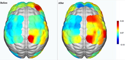Figure 13. Changes in activation of task-state brain regions before and after treatment.