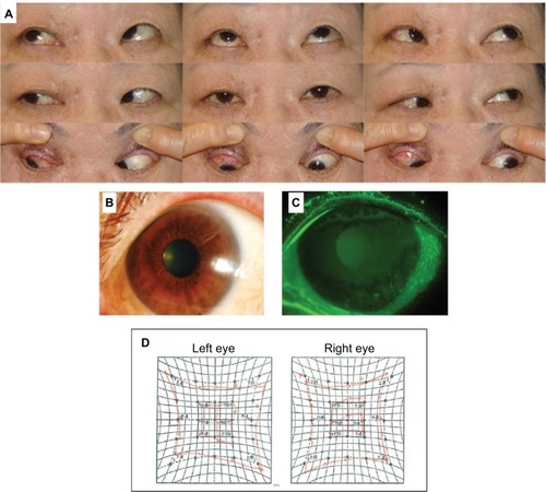 Figure 2 Postoperative findings.