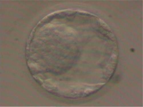 Figure 3 Microscope image (400× magnification) of blastocyst before embryo transfer (second cycle).