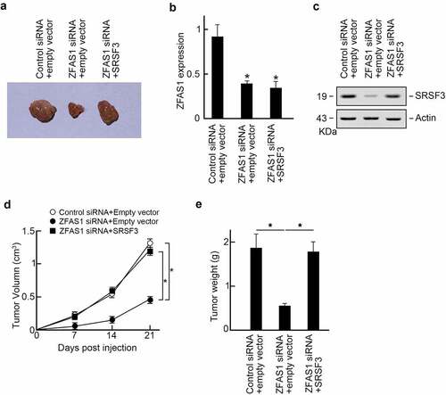 Figure 6. ZFAS1 promotes osteosarcoma progression in vivo through SRSF3.