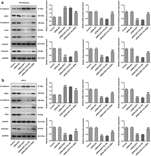 Figure 7. Overexpression of ZEB1 rescues the suppressing effects of E2F1 knockdown on EMT of trophoblast cells. HTR-8/SVneo and JEG-3 cells were transfected with siRNA-E2F1 or co-transfected with siRNA-E2F1 and Ov-ZEB1. (a, b) Western blot assay for determination of E-cadherin, ZEB1, N-cadherin, snail, slug and vimentin expressions. ***p < 0.001 versus siRNA-NC, ##p < 0.01, ###p < 0.001 versus siRNA-E2F1+ Ov-NC.