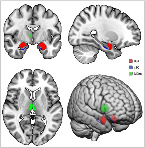 Figure 1. Subcortical regions of interest in MNI152 space. BLA: basolateral complex of amygdala; vSC: ventral subiculum of hippocampus; MDm: mediodorsal medial magnocellular area of thalamus.