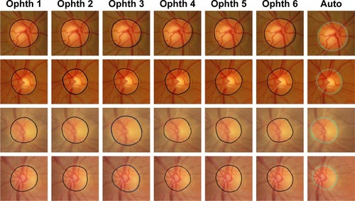 Figure 5 Examples of good disc segmentation results for both TIFF (MESSIDOR and Magrabi) and JPG (Bin Rushed) images comparing with those of six ophthalmologists.
