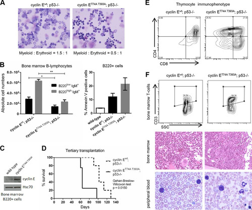 FIG 6 Recipients of cyclin ET74A T393A; p53−/− HSCs develop T-cell malignancies in a background of erythroid hyperplasia and dysplasia. (A) Representative 40× micrographs of Wright-Giemsa-stained bone marrow cytospins from wild-type recipients of cyclin Ewt; p53−/− and cyclin ET74A T393A; p53−/− bone marrow cells are shown. Myeloid-to-erythroid ratios were calculated by scoring 400 to 700 nucleated cells per genotype based on morphology. (B) Left, absolute numbers of bone marrow B-lymphocytes from recipients of cyclin Ewt; p53−/− and cyclin ET74A T393A; p53−/− HSCs (n = 14) are shown, demonstrating reduced donor-type cyclin ET74A T393A immature B cells (B220low IgM+) and recirculating/mature B cells (B220high IgM+). Right, donor-type B220+ cells from recipient mice (n = 9) were assessed for apoptosis using annexin V and 7-AAD staining. Error bars display standard errors. *, P < 0.05; **, P < 0.00001, using Student's t test. (C) Bone marrow cells from wild-type or cyclin ET74A T393A mice were enriched for B220+ B cells by immunomagnetic separation. Western blot analyses of cyclin E abundance are shown. (D) Survival curves of wild-type recipients of cyclin Ewt; p53−/− and cyclin ET74A T393A; p53−/− HSCs after tertiary transplantation are shown for the cohort subset (n = 9 out of 14 recipients) with comparable donor-type bone marrow chimerism (>60%). Survival data were analyzed using the Gehan-Breslow-Wilcoxon test (P = 0.0150) and expressed as Kaplan-Meier survival curves. (E) Representative donor-type thymocyte immunophenotyping from cyclin Ewt; p53−/− and cyclin ET74A T393A; p53−/− tertiary transplant recipients. (F) Representative flow cytometry plots displaying donor-type bone marrow CD3 expression versus side scatter (SSC) are shown for tertiary transplant recipients (top). Representative hematoxylin and eosin stains of formalin-fixed, paraffin-embedded bone marrows (middle; 40× magnification) and Wright-Giemsa-stained peripheral blood smears (bottom; 100× magnification) from recipients of cyclin Ewt; p53−/− and cyclin ET74A T393A; p53−/− HSCs analyzed as described for panel D are shown.