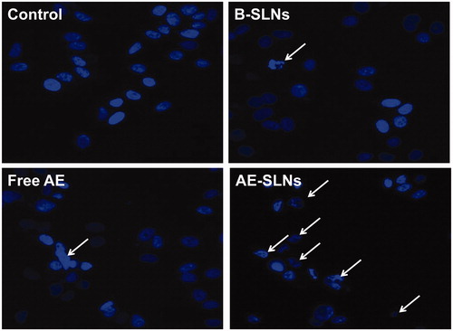 Figure 6. Hoechst 33342 fluorescent staining to detect apoptotic morphology in breast cancer cells, MCF-7 cells were treat with B-SLNs, Free AE and AE-SLNs at 2.5 μM for 48 h. The cell morphology was observed by Incell Analyzer 2000 (GE Healthcare Life Sciences, USA).