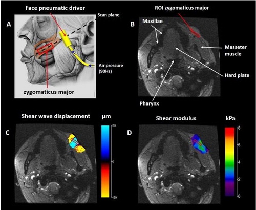 Figure 1. MRE protocol developed for the ZM muscle. A: Localization of the scan plane through the ZM and the face pneumatic driver. B: Anatomical axial T1 image with the ZM surrounded by red region of interest (ROI). C: Phase image showing the shear wave displacement. D: Cartography of the shear modulus.