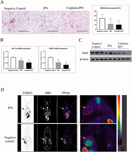 Figure 4. IPN hydrogel based TPVE suppressed tumor angiogenesis. (A) The MVD (microvessel density) was detected by anti-CD34 staining. Bar = 200 μm. The MVD per field in the tumors were compared from each group as shown in the bar chart. (B) The mRNA expression of intra-tumor HIF-1α and VEGFA were detected by RT-PCR. (C) The expressions of VEGF in the tumors from each group was detected by Western Blot. (D) The 18 F-FMISO uptake levels in IPN group and negative control group were captured by microPET-MRI scanning. (∗p < .05 differences between treatment group and negative control group).