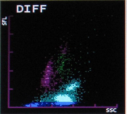 Figure 4. Two neutrophil populations.