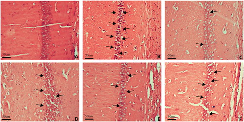 Figure 2. HE staining showing brain injuries in different groups. (A) Sham, (B) IR, (C) Hyp, (D) Hyp + HC-067047, (E) Hyp + TRAM-34 and (F) Hyp + apamin.