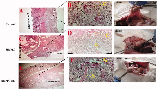 Figure 12. Histological images in tow magnification of Untreated group (A,B); for PEG/SF membrane; (C,D) and for ibuprofen-loaded PEG/SF membrane (E,F). The word “S” and “G” reprehensive the membrane and giant cells, respectively.