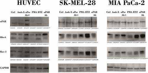 Figure 5. Reduction Rho GTPases protein levels by Amblyomin-X. Cells were treated with anti-uPAR 1:50 (30 min), followed by incubation with 20 μM Amblyomin-X (24 h). Treatments with 200 nM PMA or 100 nM bortezomib for 24 h were used as comparative. After the treatment period, cells were lysed with RIPA buffer and 30 µg of total protein was used for the assays. Western blot of the samples obtained were performed using anti-uPAR, anti-RhoA, anti-Rac-1 and anti-GAPDH antibodies as endogenous control (see experimental procedures). Densitometry analysis of protein bands (numbers below the figures) were evaluate using ImageJ analysis program and values are mean± SD of three independent experiments. Significance was compared among the treated and control (untreated cells) or between the couple of treatments (not shown). uPar Ab+: co-treament with Amblyomin-X.