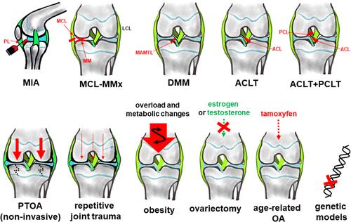 Figure 2 Most commonly used OA in vivo models. In vivo models are either established in the knee joint by application of MIA through the patellar ligament (PL) or other destructive agents (eg tamoxifen for age-related OA) which directly affect joint cartilage integrity or by creation of instability due to ligament transsection, meniscus injury or even removal. Except for MIA (sagittal) frontal views of the knee joint are depicted. OA induced by repetitive loading: by cyclic tibial compression. Joint overload by obesity. Ovariectomy impairs bone- and chondroprotective estrogen. Application of tamoxifen induces age-related OA.Citation87 The image was created by G. Schulze-Tanzil using Krita 4.1.7 Software.