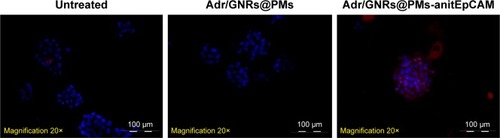 Figure 2 Identification of Adr/GNRs@PM-antiEpCAM in Hepa1-6 cell spheroids.Notes: Blue: DAPI positive staining of nuclei in the spheroid. Red: positive staining of antiEpCAM which were labeled Adr/GNRs@PMs.Abbreviations: Adr, Adriamycin; EpCAM, epithelial cell adhesion molecule; GNR, gold nanorod; PM, polymeric nanomicelles.