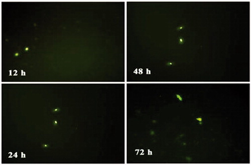Figure 10. Fluorescence photomicrographs of green fluorescent protein expression of NPs-c-Myc-siRNA3-pDNAs after transfection for 12 h, 24 h, 48 h, and 72 h.