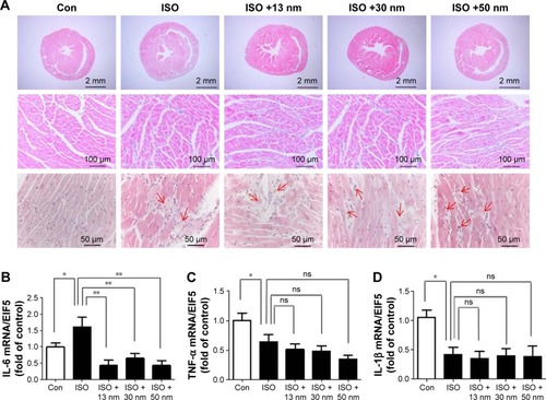 Figure 5 The effects of AuNPs on inflammation in the heart.Notes: (A) Representative images showing H&E staining of heart sections. The arrows refer to the infiltrated inflammatory cells. The scale bars of 12.5× images are 2 mm, of 250× images are 100 μm, and those of 500× images are 50 μm. (B) The mRNA expression of IL-6 in the heart tissue. (C) The mRNA expression of TNF-α in the heart tissue. (D) The mRNA expression of IL-1β in the heart tissue. *P<0.05, **P<0.01. Data represent mean ± SEM.Abbreviations: AuNPs, gold nanoparticles; H&E, hematoxylin and eosin; ISO, isoproterenol; Con, control; ns, no significance.