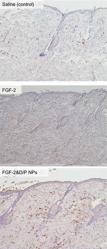 Figure 3 FGF-2 antibody staining of the F344 rat dorsal skin with applied saline (control), standalone FGF-2, or FGF-2&D/P NPs.