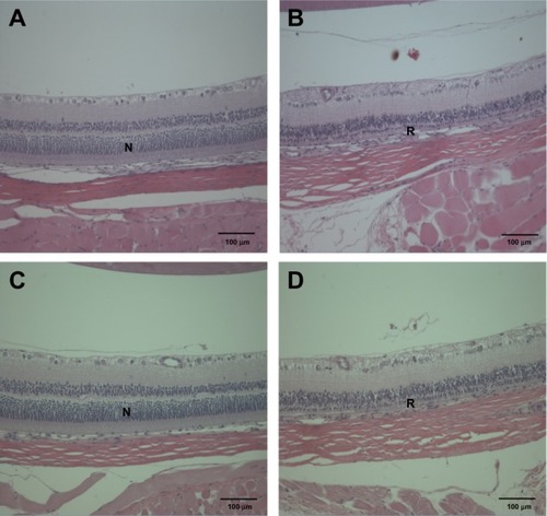 Figure 7 Histopathological changes in the eye after treatment with (A and B) ZnOAE100(−) and (C and D) ZnOAE100(+) at a dose of 500 mg/kg for 90 days. Eye sections were stained with hematoxylin and eosin. (A and C) Control for the eye. (B and D) 500 mg/kg treatment groups.Abbreviations: N, normal eye; R, retinal atrophy; ZnO, zinc oxide; ZnOAE100(−), 100 nm negatively charged ZnO; ZnOAE100(+), 100 nm positively charged ZnO.