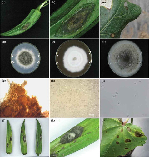 Fig. 1 (Colour online) Symptoms of (a–b) brownish black spots on fruits, and (c) medium brown to greyish white spots on leaves of naturally infected okras in the field. Colony on (d) PDA, (e) MEA and (f) OA at 25°C for 14 days. Microscopic structures of (g) pycnidia and (h–i) conidia. Symptoms observed in pathogenicity tests (j–k) on fruits, and (l) on leaves. Bars: g = 100 μm, h-i = 20 μm.