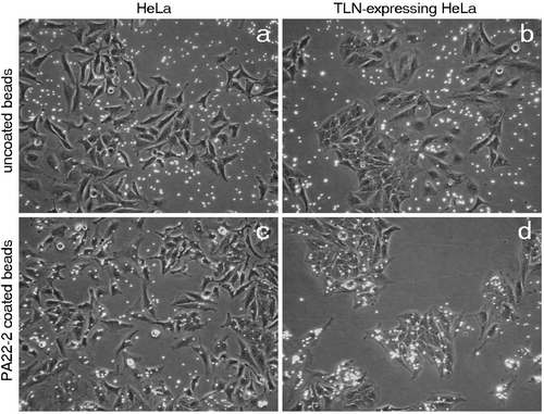 Figure 7. Interaction of HeLa cells with microbeads. (a) and (c) are control HeLa cells, (b) and (d) are HeLa cells stably transfected with full length TLN. The uncoated beads (a) and (b) are scattered in between the cells. The PA22-2 coated beads (c) and (d) bind to control HeLa cells and with more preference to the stable TLN expressing line.