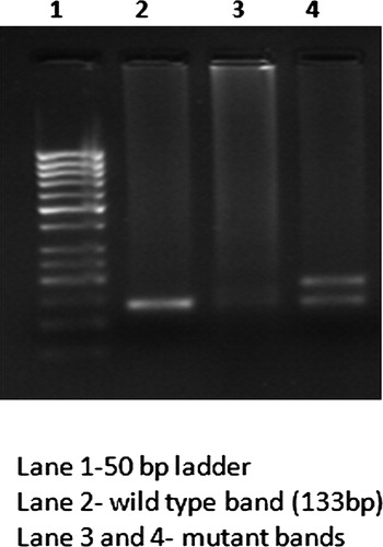 Figure 1. Gel picture of FLT3-ITD mutants.
