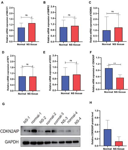 Figure 7 Verification of selected differentially expressed transcripts in NS-paired adjacent tissue pairs. Real-time PCR was performed to validate the expression of the complementary gene targets identified by differentially expressed mRNAs in this study (**P < 0.01). Western blot was performed to further validate the protein expression of the gene product. (A) RT-PCR of MACC1 expression. (B) RT-PCR of BMPR2 expression. (C) RT-PCR of KDM3A expression. (D) RT-PCR of RIF1 expression. (E) RT-PCR of DDX5 expression. (F) RT-PCR of CDKN2AIP expression. (G) Protein expression result of CDKN2AIP in four-pair of NS and normal tissue samples. (H) Relative protein expression of CDKN2AIP.