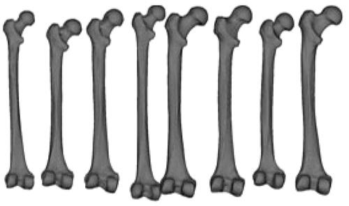 Figure 4. Samples of 3 D femur surface models were constructed from the CT images used in the experiments.