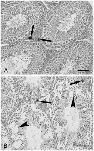 Figure 1. Light microscopy. Trypan blue treated mice. (A) Control mouse. Some seminiferous tubules with normal appearance are shown. The arrows point to two testicular macrophages. (B) Alcohol treated mouse. The morphology of the seminiferous tubules is severely altered. The tubules show reduced thickness and vacuolization (arrowheads). The arrows point to two testicular macrophages. Scale bars: 50 µm.