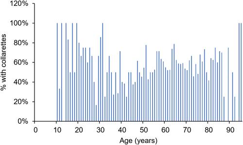 Figure 2 Prevalence of Demodex blepharitis by age of patients.