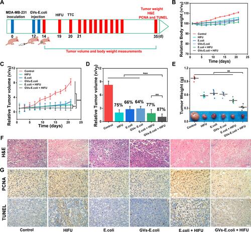 Figure 8 The anticancer effect of combination therapy. (A) The schematic illustration of the treatment protocol. (B) Bodyweight changes over time. (C) Tumor volume of different groups (n = 5, **P<0.01, ***P<0.001). (D) IRT of different groups (n = 5, **P<0.01, ***P<0.001). (E) Tumor weight on the 21st day (Insert: digital photos of tumors on the 21st day) (n = 5, **P<0.01). (F) Optical microscope images of tumor sections from each group after HIFU ablation were stained for HE staining. (G) PCNA and TUNEL staining of tumor sections from various treatment groups for observing proliferation and apoptosis. All the scale bar is 50 µm.