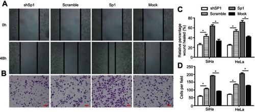 Figure 3 Sp1 promotes migration and invasion of cervical cancer cells in response to radiation. (A). Wound-healing assay of the four groups in cervical cancer cells. (B). Transwell migration assay of the four groups in cervical cancer cells (scale bar, 50 μm). (C). Cell migration was quantified as percentage of wound-healed area. (D). Average number of invading cells per field from three independent experiments. Data represent means ± SD of five randomly selected areas. *P<0.05.