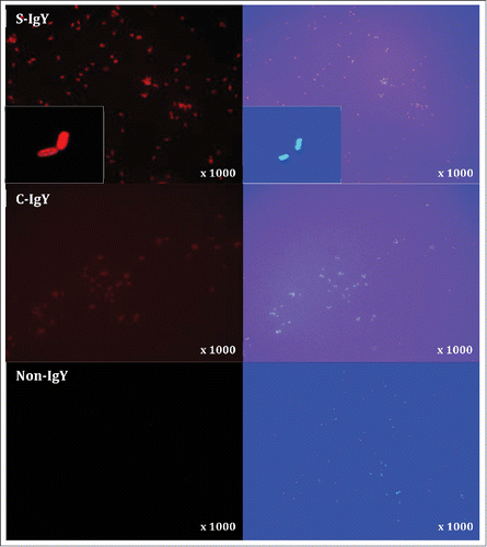 Figure 6. Indirect immunofluorescence images of Pseudomonas aeruginosa (PAO1) stained with S-IgY/C-IgY or non-IgY primary antibodies and Texas Red-conjugated rabbit anti-chicken IgG secondary antibody. Images of the bacteria at higher magnification (x1000) and close-ups (inserts) are displayed.