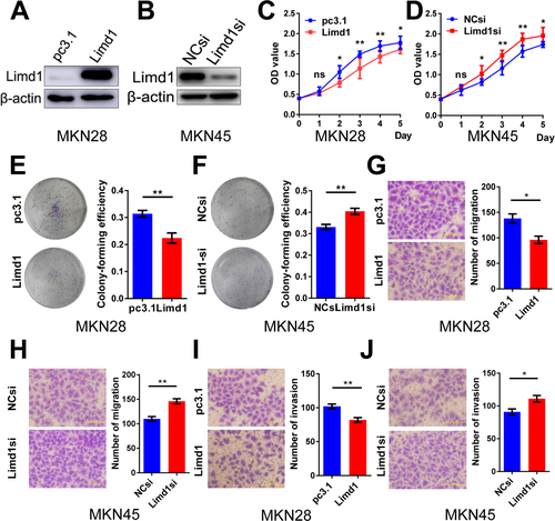 Figure S1 LIMD1 impedes tumor growth in GC cell lines.Notes: (A, B) Western blot shows that the LIMD1 expression levels in MKN28 cells transfected with LIMD1 overexpression vector (A) and MKN45 cells transfected with LIMD1-siRNA (B). (C, D) Proliferation curves of MKN28 cells transfected with LJMD1 overexpression vector (C) and MKN45 cells transfected with LIMD1-siRNA (D). (E, F) Colony formation assay of MKN28 cells transfected with LIMD1 overexpression vector (E) and MKN45 cells transfected with LIMD1-siRNA (F). (G, H) Cell migration assays of MKN28 cells transfected with LIMD1 overexpression vector (G) and MKN45 cells transfected with LIMD1-siRNA (H). (l, J) Cell invasion assays of MKN28 cells transfected with LIMD1 overexpression vector (I) and MKN45 cells transfected with LIMD1-siRNA (J). The representing plates are shown on the left, and the quantification bars are shown on the right in (E–J). All the microscopy assays were pictured under 40×. Each panel represents at least three independent experiments. *P<0.05; **P<0.01. LIMD1, LIMD1 overexpression vector; pc3.1, empty vector.Abbreviations: GC, gastric cancer; LIMD1si, LIMD1-siRNA; NCsi, negative control siRNA; NS, no significance.